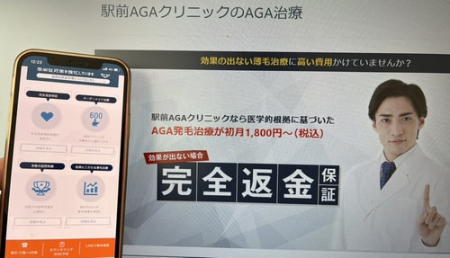 駅前AGAクリニックのAGA治療