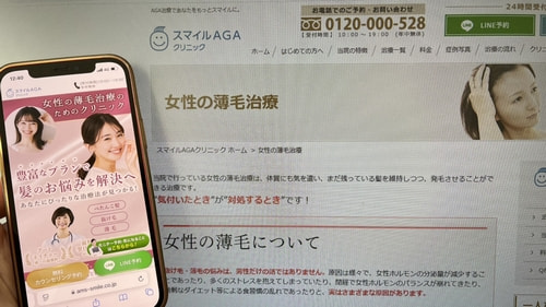 スマイルAGAクリニックのFAGA治療