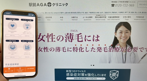 駅前AGAクリニックのFAGA治療