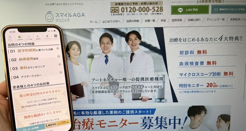 スマイルAGAクリニックのAGA治療