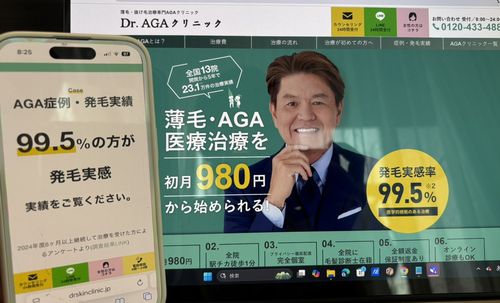 Dr.AGAクリニックのAGA治療