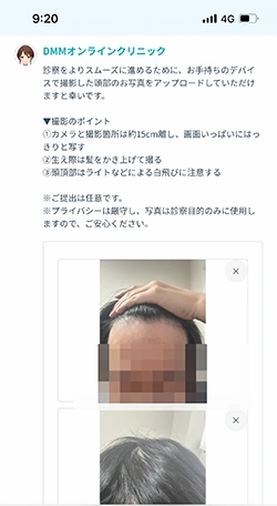 DMMオンラインクリニックでAGAの問診票を作っている画像