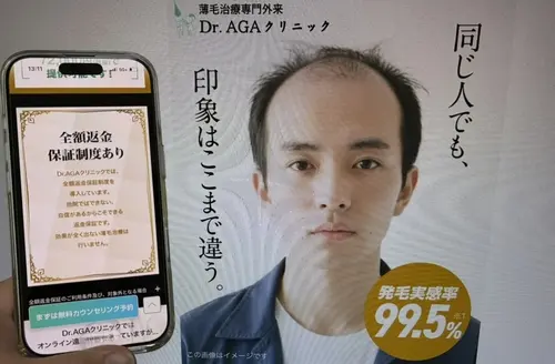 Dr.AGAクリニックのAGA治療