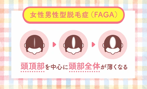 FAGAの進行の仕方