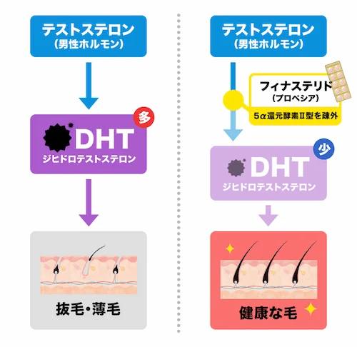 フィナステリドの効果と発毛メカニズム